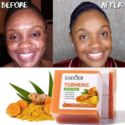 50% Off Organic Turmeric + Kojic acid Soap Face Cleansing & Whitening